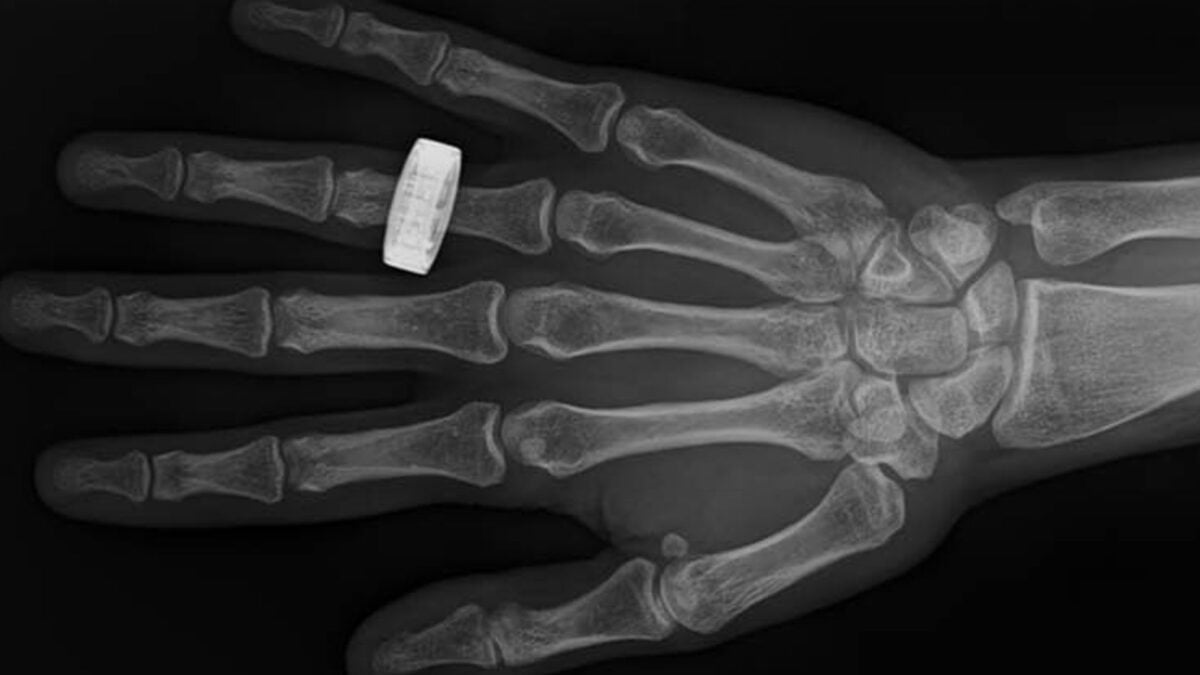 Pioneering Space Healthcare: The Dawn of Onboard Medical X-rays